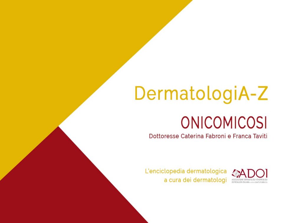Onicomicosi