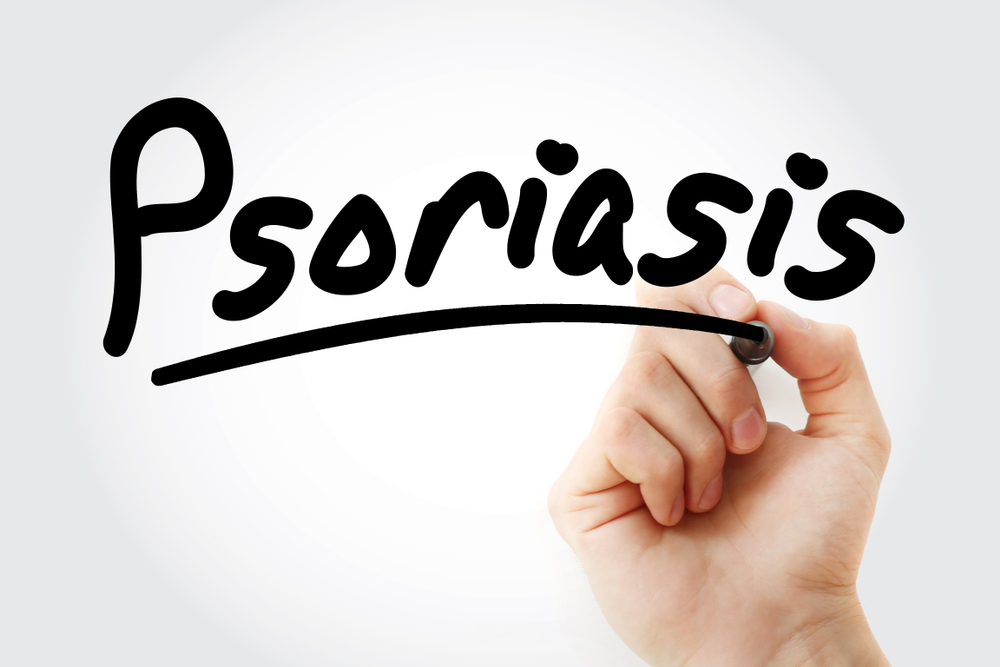 psoriasi